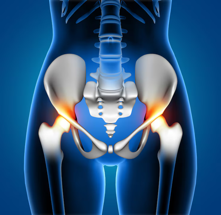 Hip - Fracture - Surgery - (Dr Vijaya Krishnan - orthovijay - life span - life span clinic)