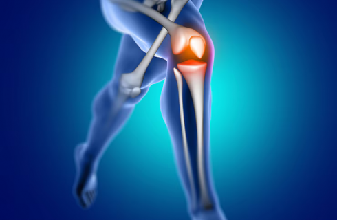 knee - Replacement - Surgery - (Dr Vijaya Krishnan - ortho vijay - life span - life span clinic)
