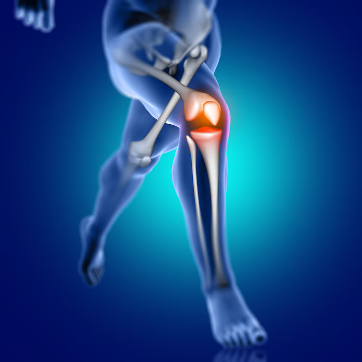 knee - Replacement - Surgery - (Dr Vijaya Krishnan - ortho vijay - life span - life span clinic)