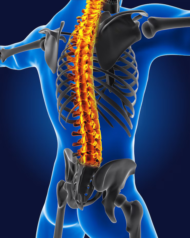 Spine - Surgery - (Dr Vijaya Krishnan - orthovijay - life span - life span clinic)