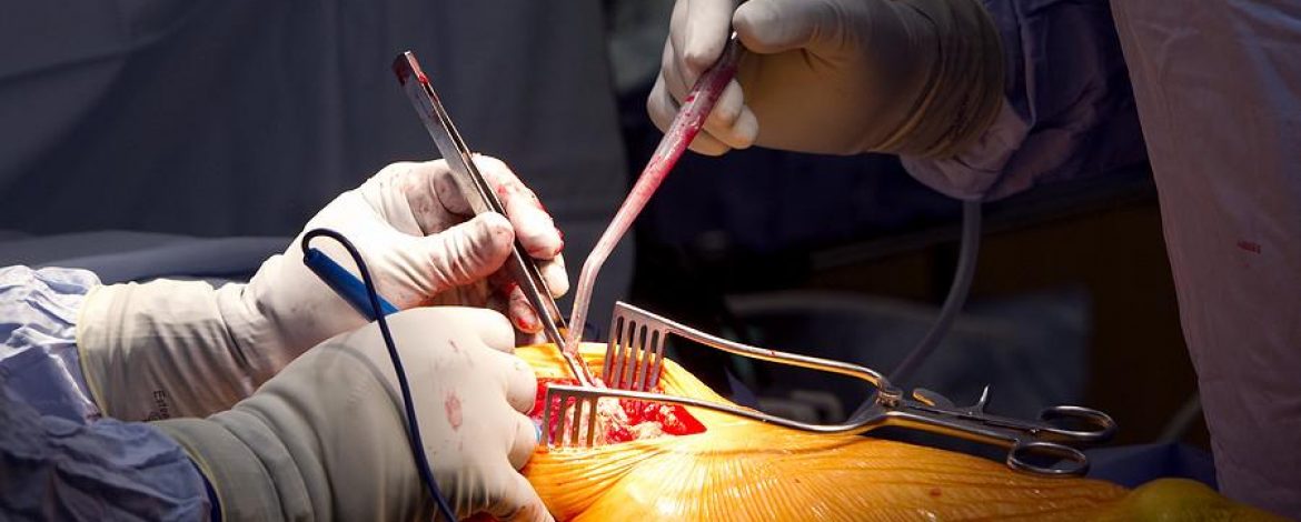 Potential Risks and Complications of Hip Surgery