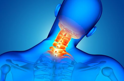 Cervical - Spinal - Surgery - Orthopedic-Treatment - (Dr Vijaya Krishnan - Orthovijay - life span - life span clinic)