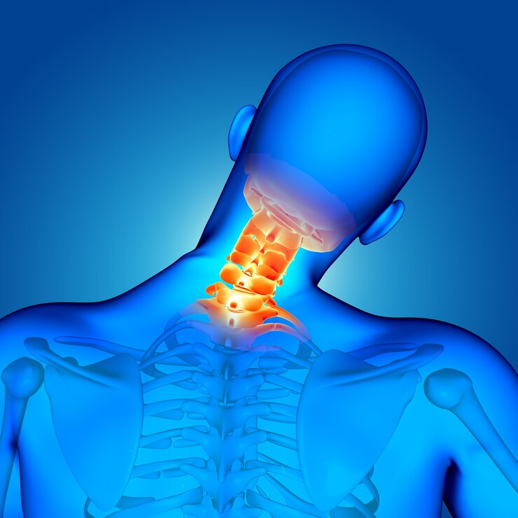 Cervical - Spinal - Surgery - Orthopedic-Treatment - (Dr Vijaya Krishnan - Orthovijay - life span - life span clinic)