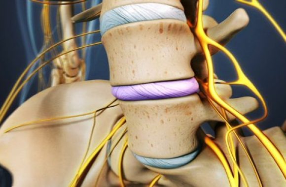 Lumbar - Spine - Fusion - Surgery - Orthopedic - Trauma - Surgery - Spinal - Fusion - Surgery - Life - Span - Hassle - Free - Patient -Arrangements - life _ Span - life _ Span - life - span - bone - & - joint - clinic- Orthopedic-Treatment - (Dr Vijaya Krishnan - Orthovijay - life span - life span clinic)