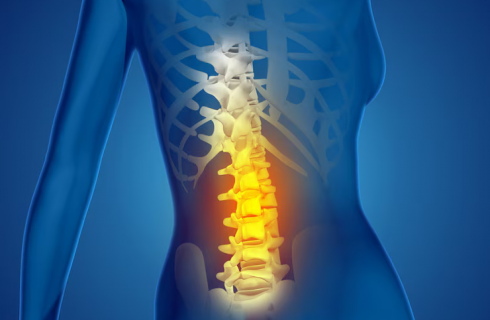 Lumbar - Spine - Surgery - Orthopedic-Treatment - (Dr Vijaya Krishnan - Orthovijay - life span - life span clinic)