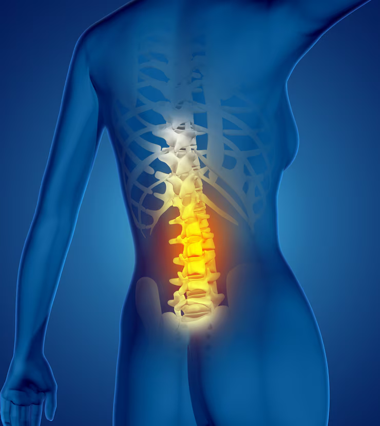 Lumbar - Spine - Surgery - Orthopedic-Treatment - (Dr Vijaya Krishnan - Orthovijay - life span - life span clinic)