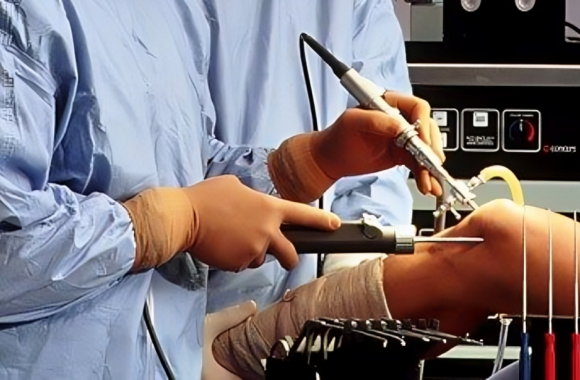 Orthopedic - Trauma - Surgery - Spinal - Fusion - Surgery - Life - Span - Hassle - Free - Patient -Arrangements - life _ Span - life _ Span - life - span - bone - & - joint - clinic- Orthopedic-Treatment - (Dr Vijaya Krishnan - Orthovijay - life span - life span clinic)