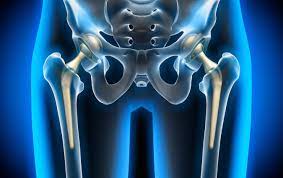 Hip - Replacement - Surgery - Orthopedic-Treatment - (Dr Vijaya Krishnan - Orthovijay - life span - life span clinic)