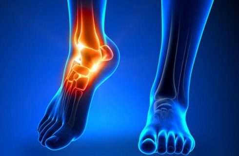 Poly - Trauma - Orthopedic-Treatment - (Dr Vijaya Krishnan - Orthovijay - life span - life span clinic)