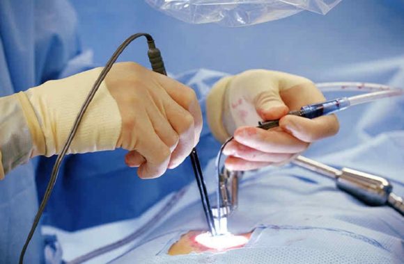 Minimally - Invasive - Spine - Surgery - Lumbar - Spine -Surgery - Life - Span - Hassle - Free - Patient -Arrangements - life _ Span - life _ Span - life - span - bone - & - joint - clinic- Orthopedic-Treatment - (Dr Vijaya Krishnan - Orthovijay - life span - life span clinic)