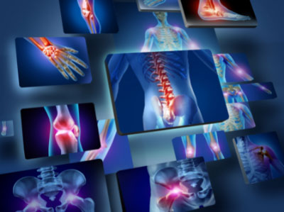 Orthopedic - Sports - Medicine - (Orthopedic-Treatment- Orthovijay - Lifespan - Life - Span - clinic )