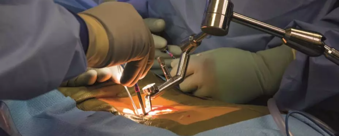 Overview of Lumbar Spine Surgery: Indications and Techniques